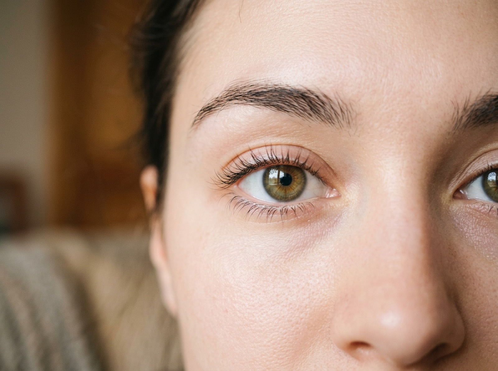 Bright rested eyes representing blepharoplasty eyelid surgery results at KCC London