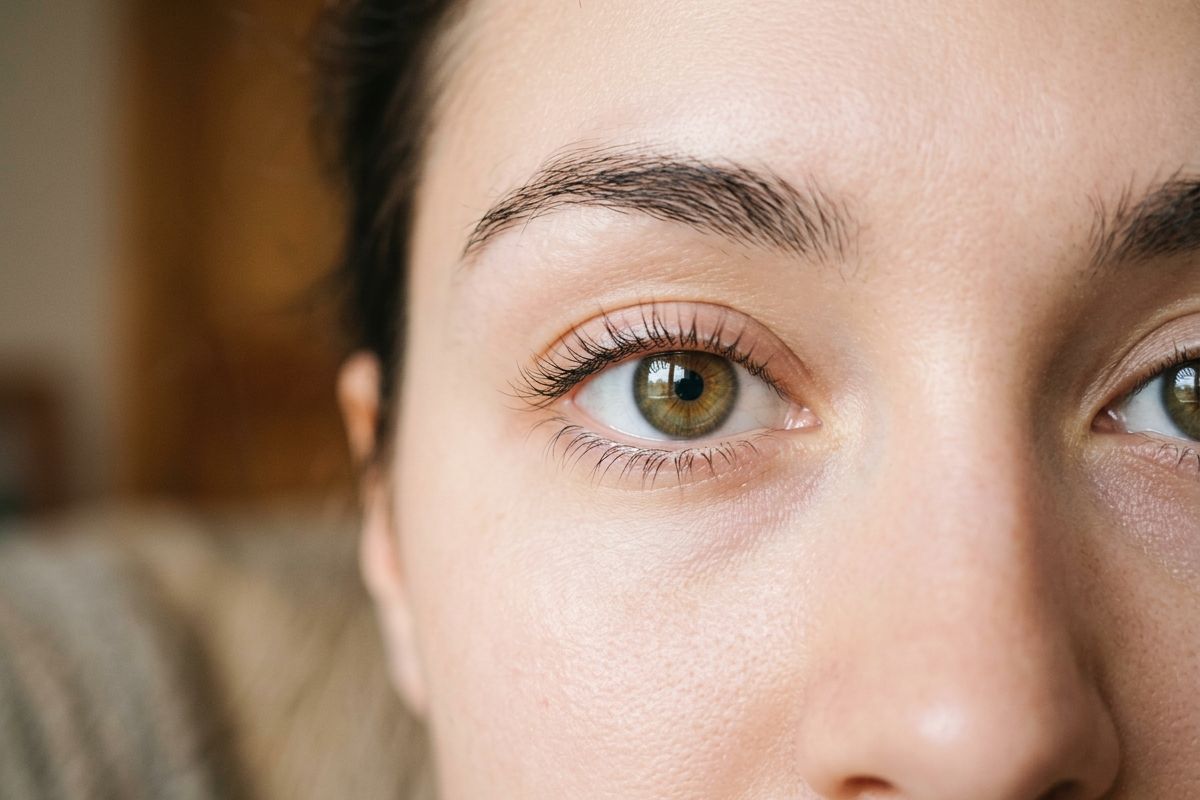 Bright, rested eyes with smooth eyelids after blepharoplasty at Kensington Cosmetic Clinic