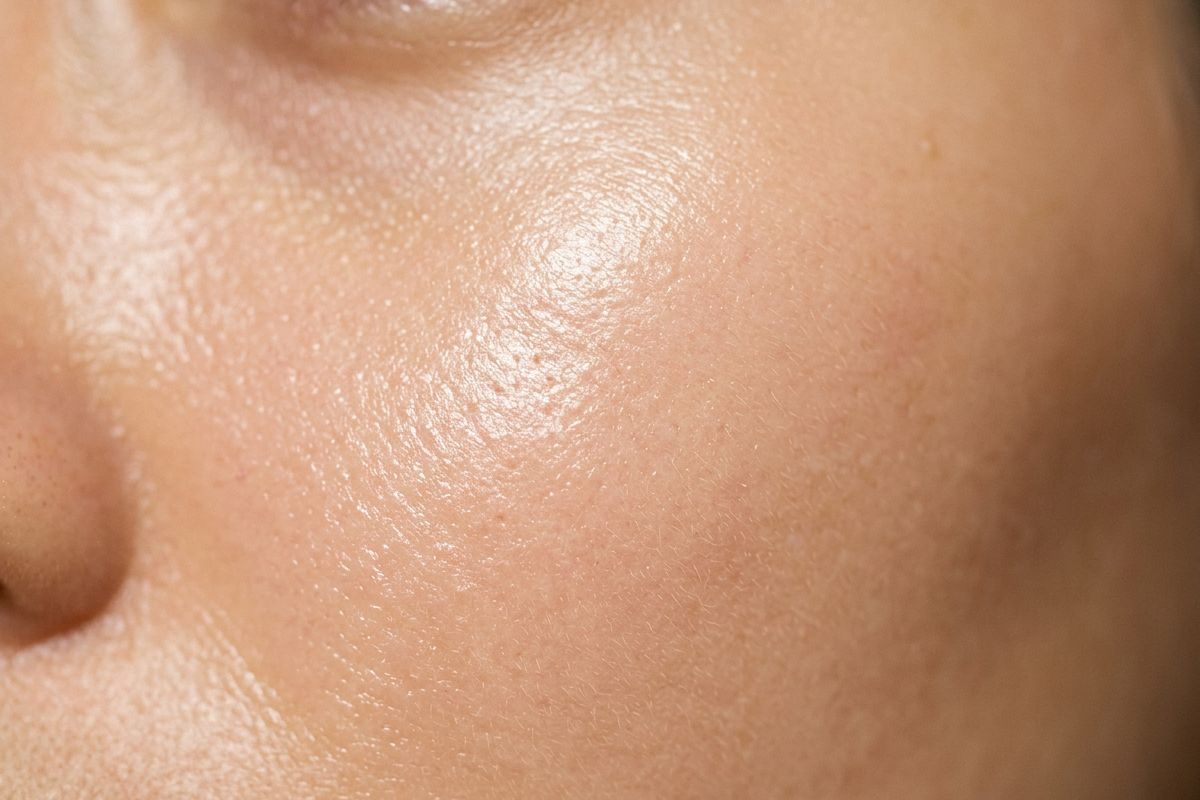 Practitioner performing CO2 laser resurfacing on a patient at Kensington Cosmetic Clinic