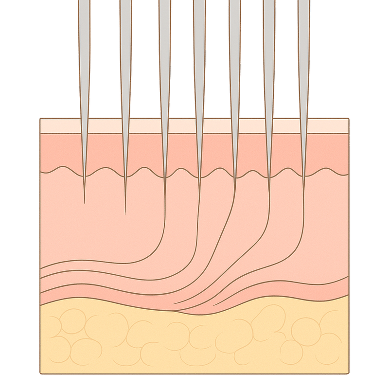 Inside microneedling, anatomical illustration